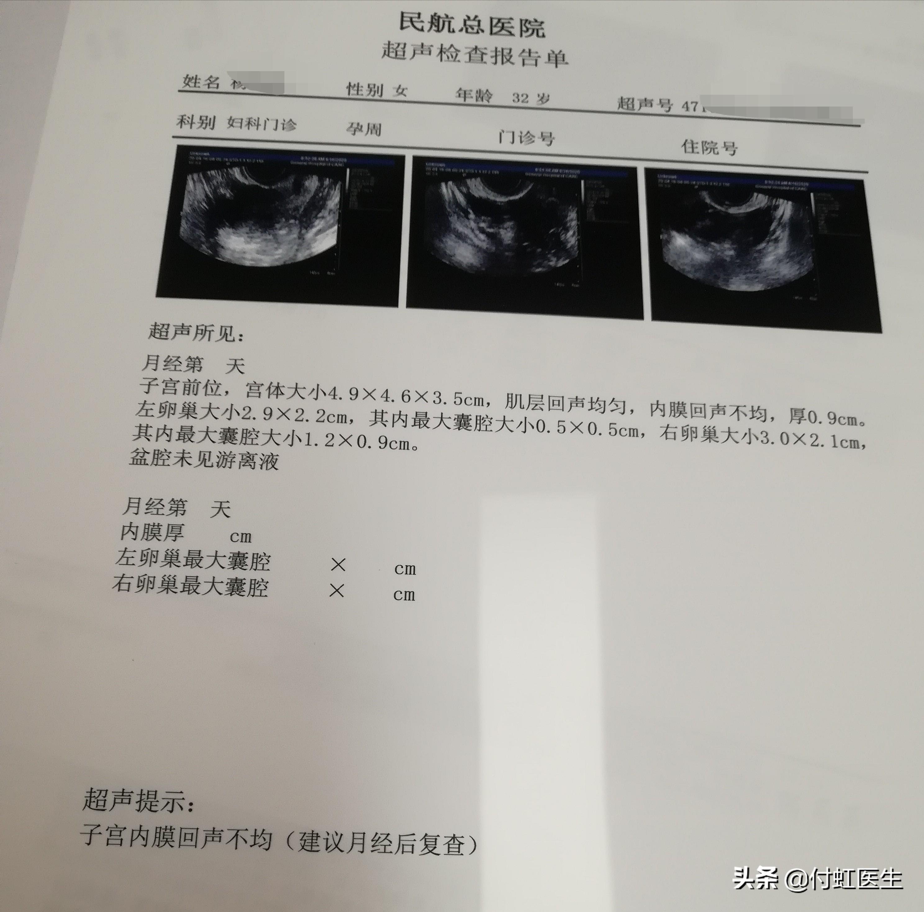 最新B超單，解讀孕期胎兒健康狀況的關(guān)鍵所在